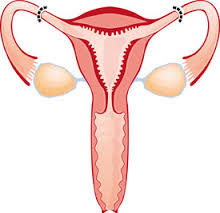 Ligatura trompelor uterine