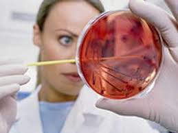 Testul Babes Papanicolau