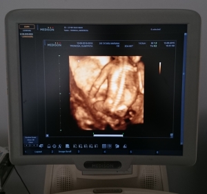 Cabinet de consultatie si investigatii obstetrica ginecologie Dr.Victoria Tudosa.